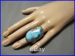 Huge And Thick! Vintage Navajo Old Morenci Turquoise Sterling Silver Ring